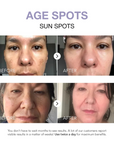 Klyne RX™ - Rapid Dark Spot Corrector