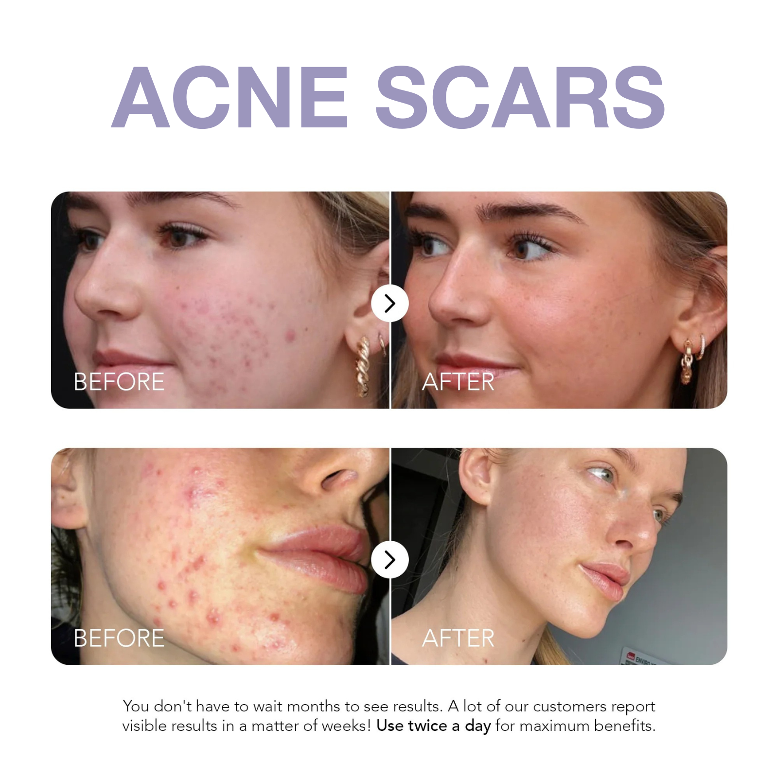 Klyne RX™ - Rapid Dark Spot Corrector