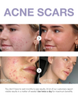 Klyne RX™ - Rapid Dark Spot Corrector