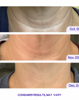 Key-Lift™ -  Tighten & Lift Neck Cream