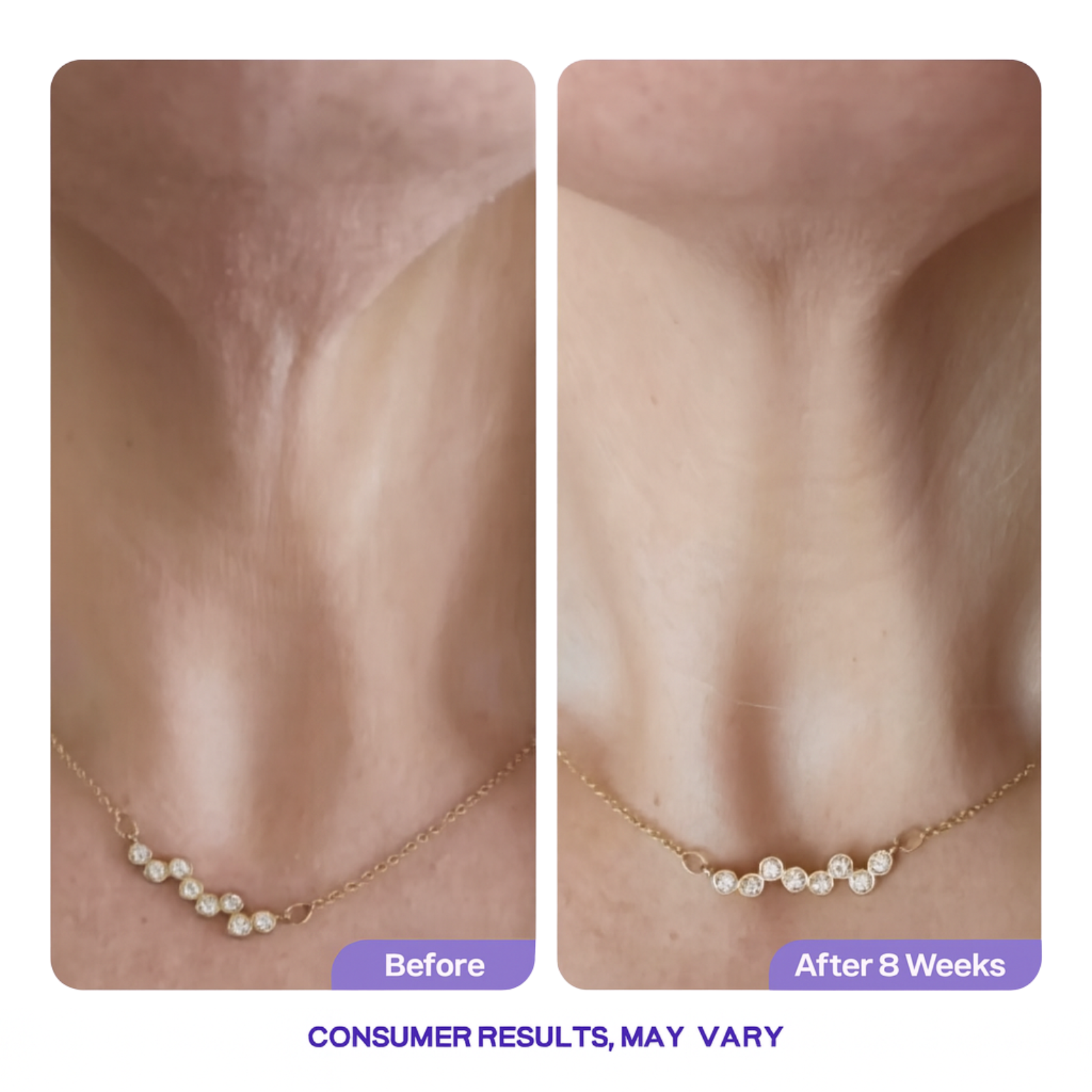 Key-Lift™ -  Tighten & Lift Neck Cream