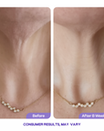 Key-Lift™ -  Tighten & Lift Neck Cream