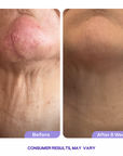Key-Lift™ -  Tighten & Lift Neck Cream