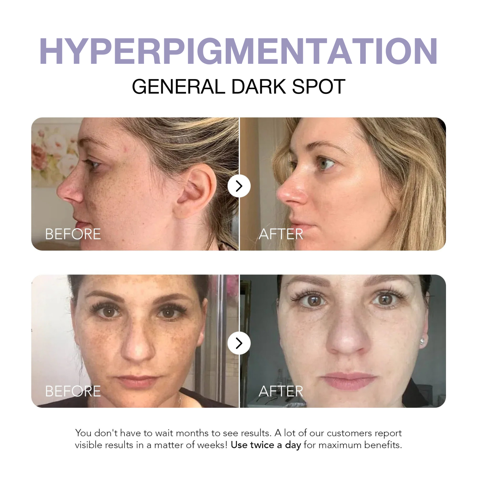 Klyne RX™ - Rapid Dark Spot Corrector