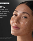 Klyne RX™ - Rapid Dark Spot Corrector